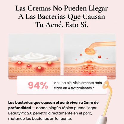 Máquina de Alta Frecuencia Facial Beauty Pro® — Trata el Acné desde su Origen | 4 Electrodos