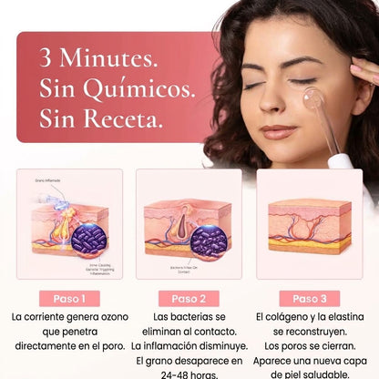 Máquina de Alta Frecuencia Facial Beauty Pro® — Trata el Acné desde su Origen | 4 Electrodos